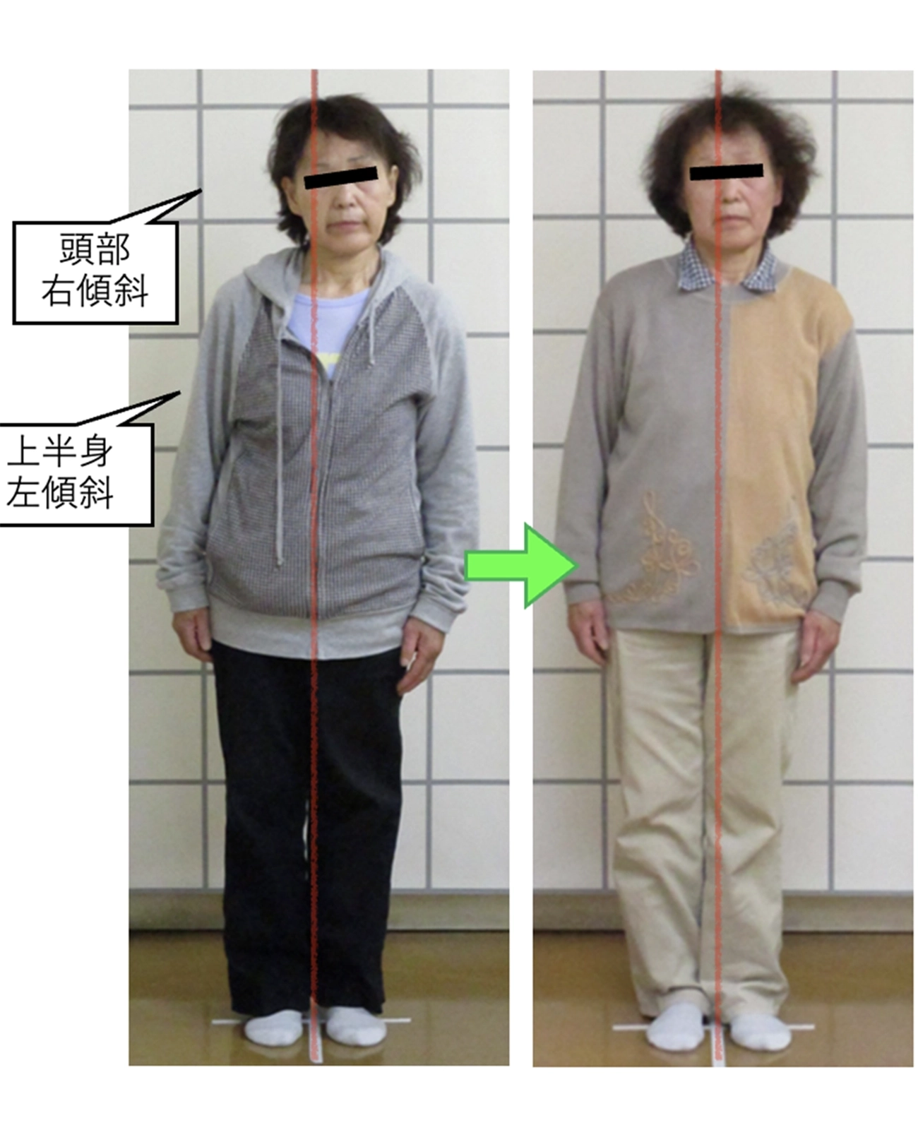 治療前