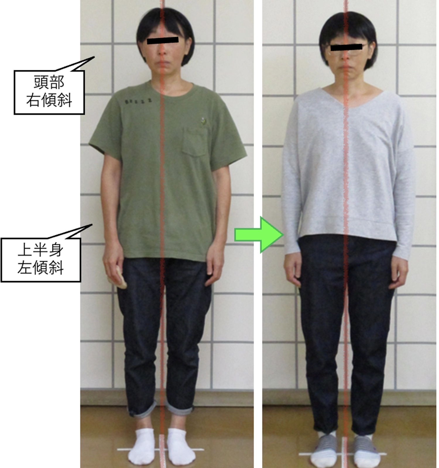 治療前