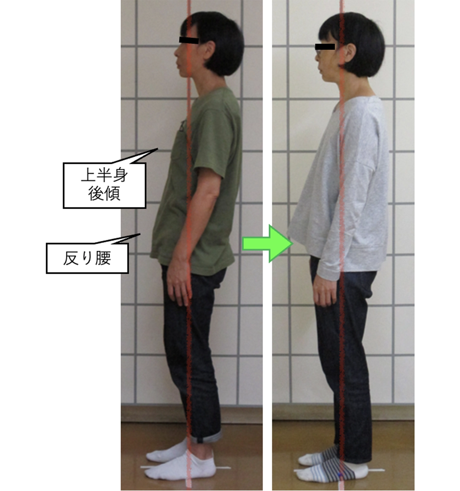 治療後