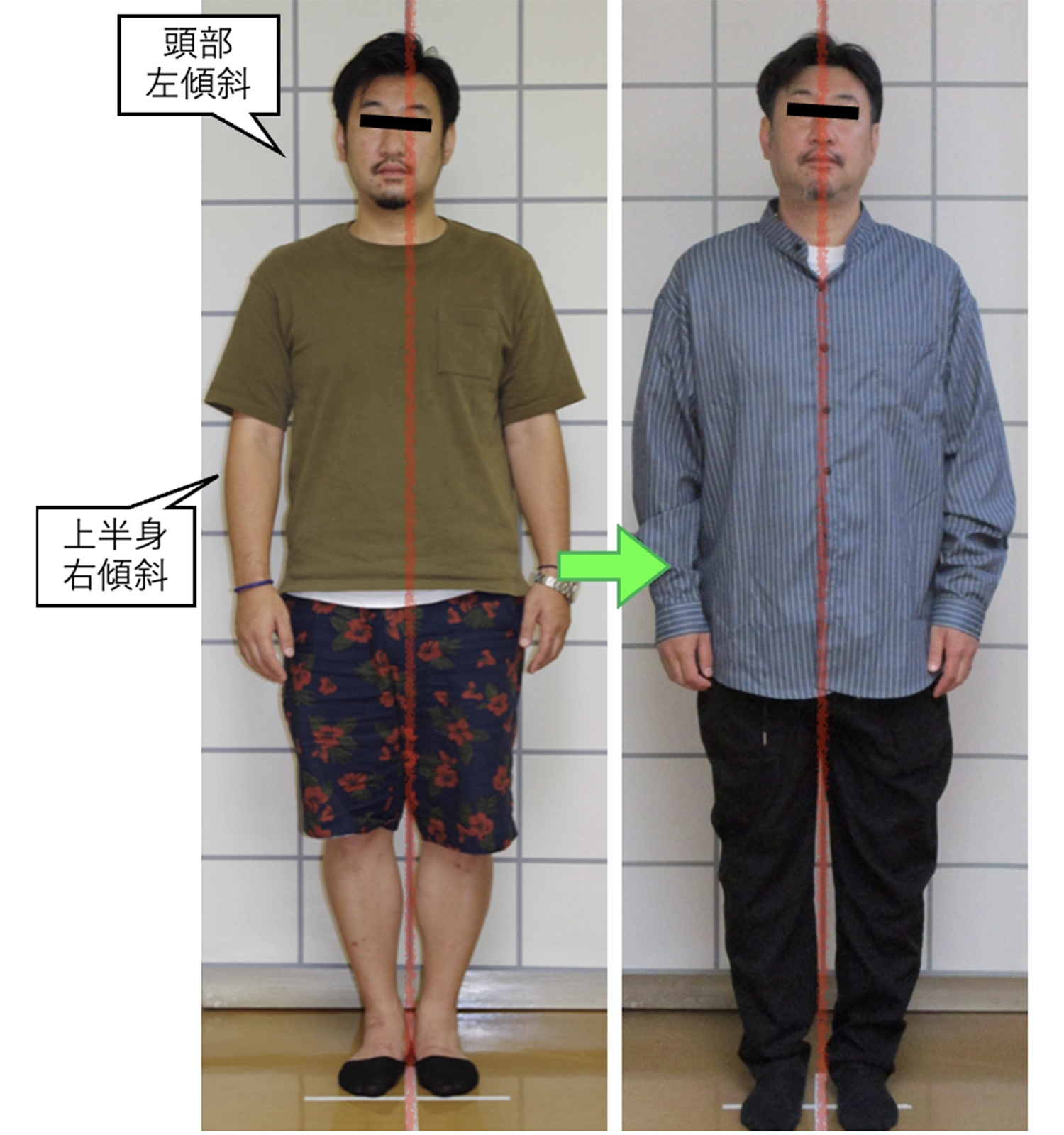 治療前