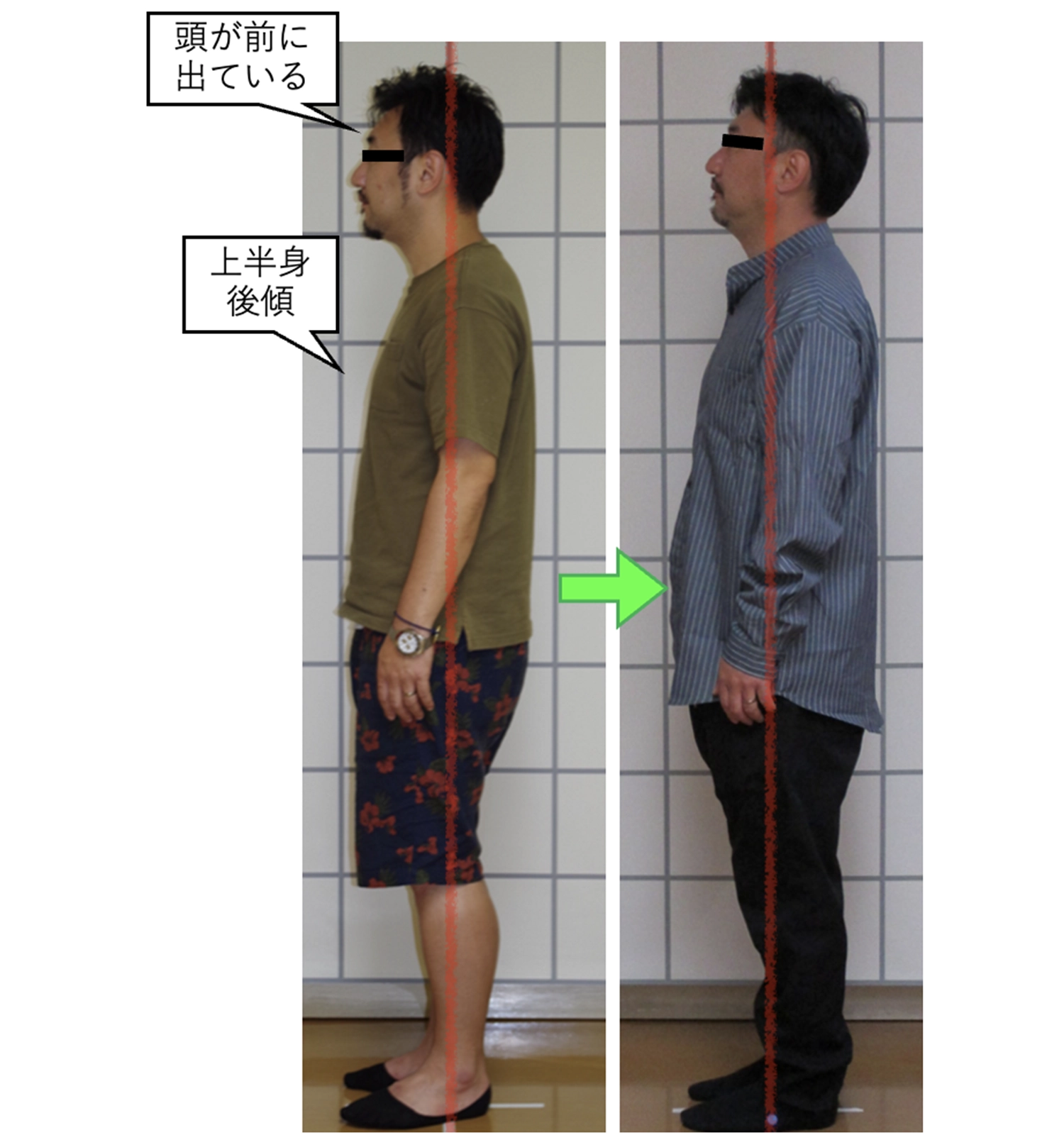 治療後